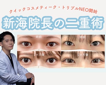 【SBC水戸院】クイックコスメティーク・トリプルNeoが導入されました‼️茨城県｜水戸市で二重術するなら湘南美容クリニック水戸院へ